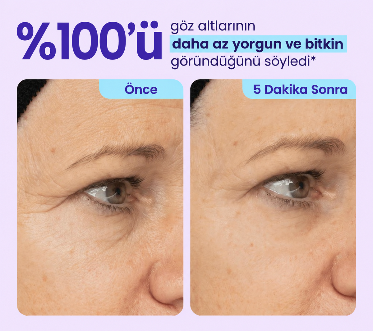 NoaPure Instant Eye Lift Gel | Göz Çevresi Bakım Jeli