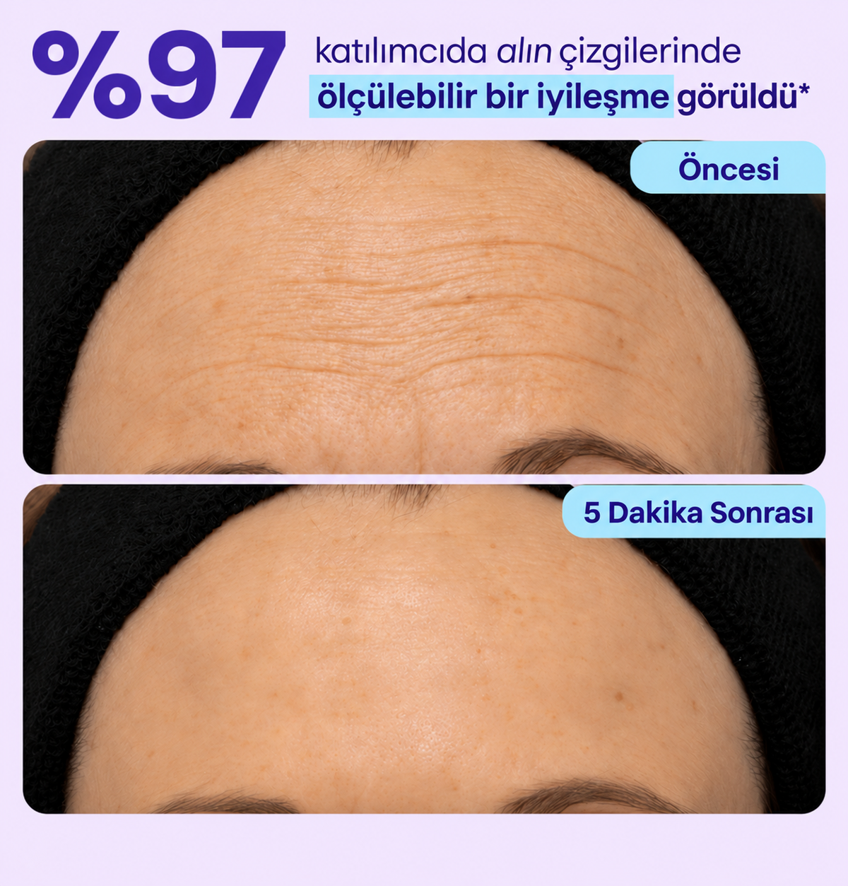 NoaPure Instant Eye Lift Gel | Göz Çevresi Bakım Jeli