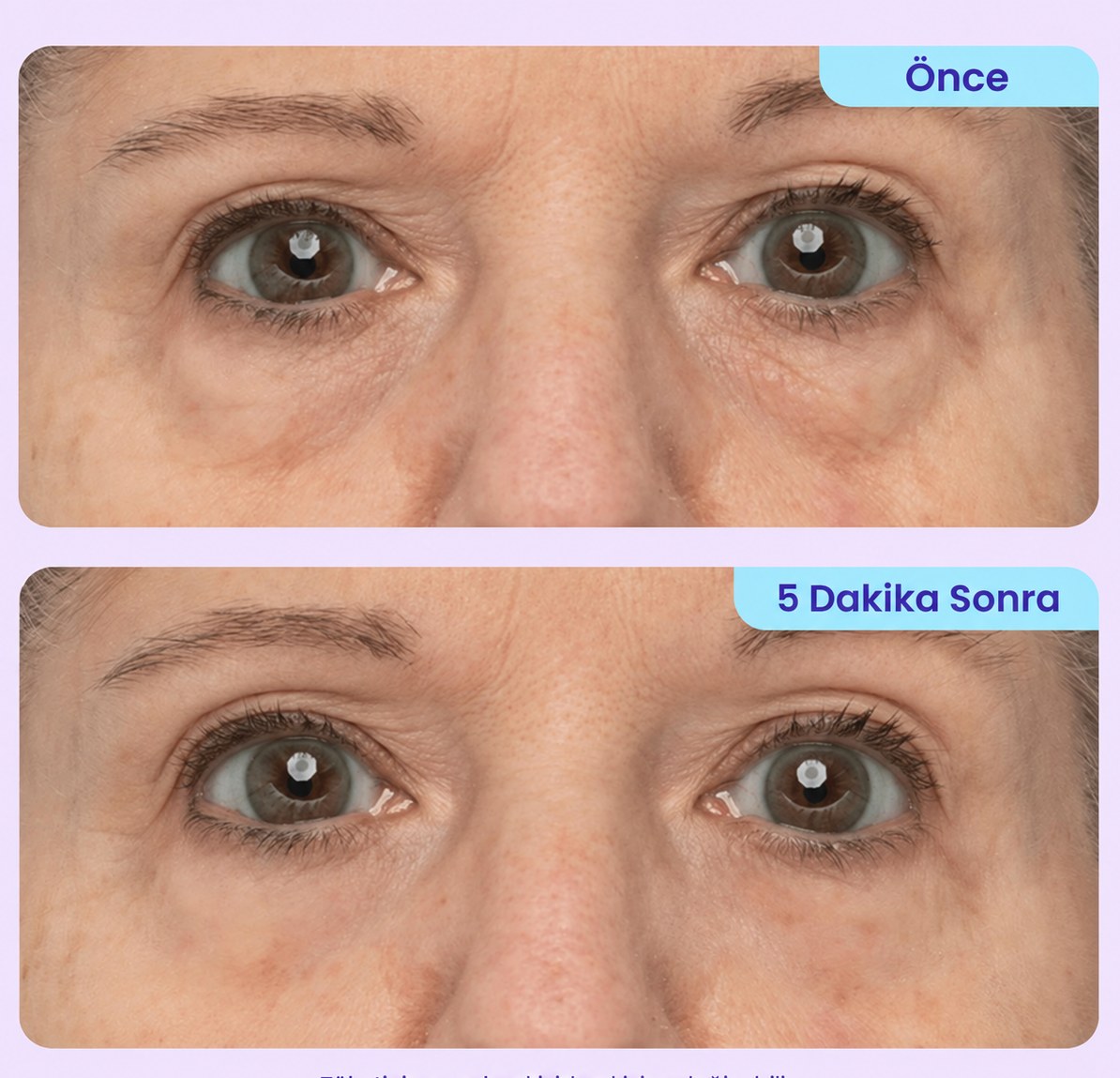 NoaPure Instant Eye Lift Gel | Göz Çevresi Bakım Jeli